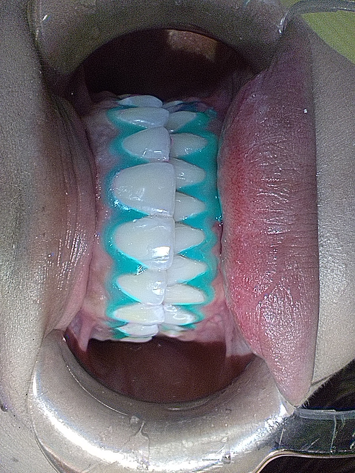 Caso 01 · Diseño de sonrisa