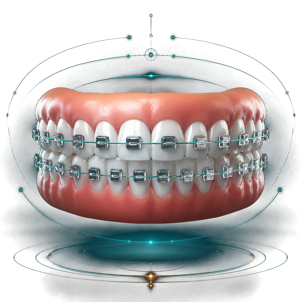 Ortodoncia con brackets